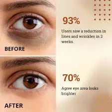 Glowrify Eyelight Serum Dark Circle Remover Around Puffy Eyes 15 ML